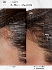 FutureIQ™ biomimetic hair longevity serum